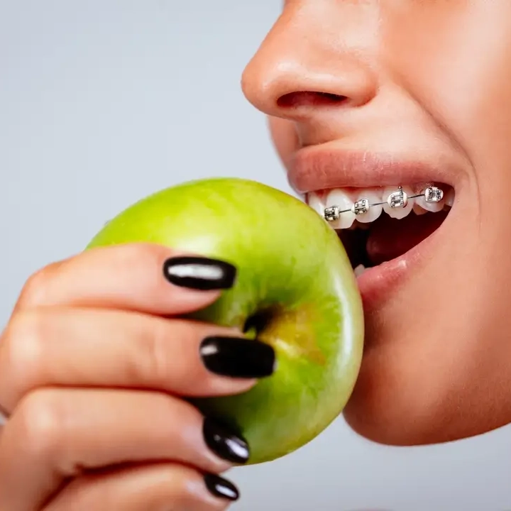 eating and drinking with braces vs invisalign