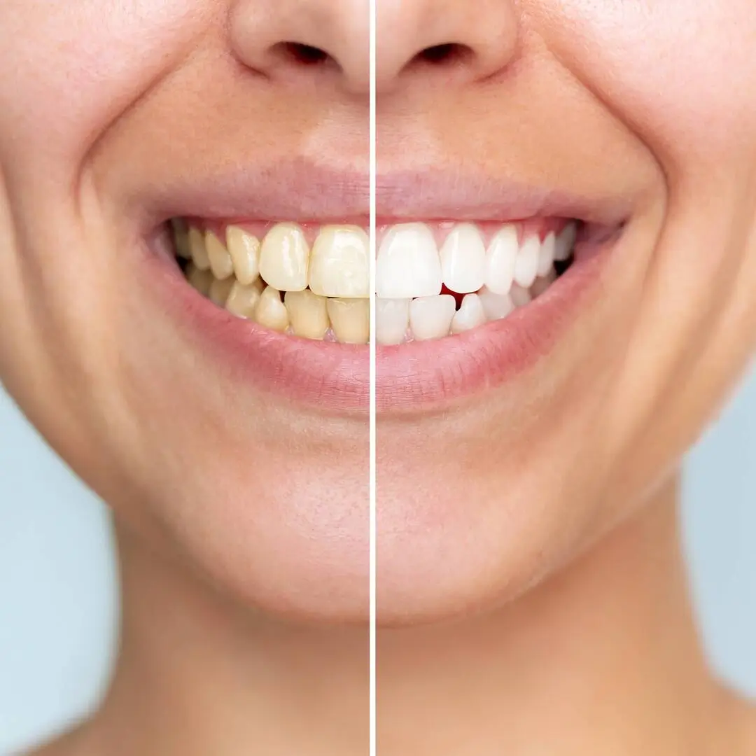 reasons you should see a dentist