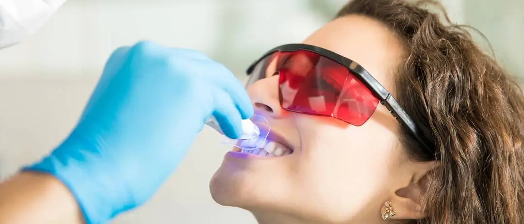 teeth whitening cost as home vs in-office